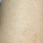 혐주의) 얘들아 왁싱 해라 진짜 ㅈㅂ