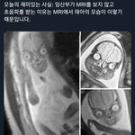 [드루와] 10대판 금지어 만들자