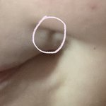 [댓글부탁해] 얘들아 이거 웃을 때 생기는 거 머야..?