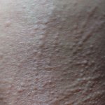 혐주의)엔터랑 관련없음 주의)<b>콜린</b>성 너무 싫다.