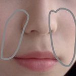 얼굴살 빠지면 이 <b>주름</b> 없어짐??