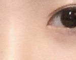쌍수 <b>재수술</b> 해? 말아?