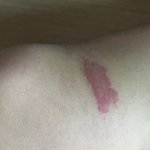 [19] 와 나 <b>모기</b> 물린데 봐봐
