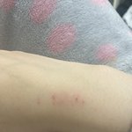 비몽사몽한채로 털 <b>밀지</b>마라.. 나처럼됨