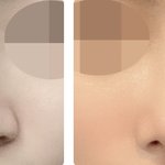 아니 이건 어케 성형 하는거야