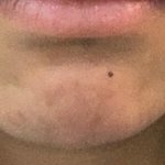 [이것좀봐줘] 대구 성형외과