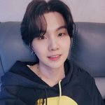 슈가 왜 얼굴이 <b>반쪽</b>이 되셨어