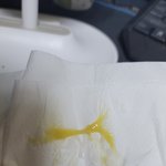 혐오,더러움) 노란 <b>콧물</b> 이거 뭐에요?