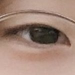 나 <b>쌍수</b> 잘 됨?