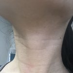 나 목주름 뭔데 ㅅㅂ (<b>극혐</b>주의)