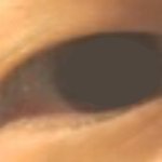 [댓글부탁해] <b>무쌍</b>이 눈 부으면 어케 되게