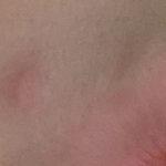 [댓글부탁해] 얘들아 나 내일 퍼스널 <b>컬러</b> 가는데 이거 뾰루지 짤까말까