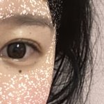 <b>눈물점</b> 이상함?