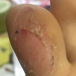 <b>omg</b> what happen to my 발가락!!!!