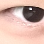이런 눈은 뭐 어떻게 해야함
