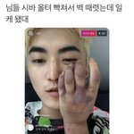 피부 이런건 어케해야됨..