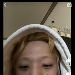 양<b>홍원</b> 얼굴 왜이럼