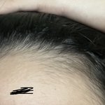 나만 <b>이마</b>털 ㅈㄴ 많냐?