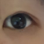 [댓글부탁해] 쌍수가 이렇게 망할 <b>수도</b> 있어.??