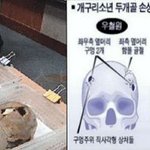 개구리<b>소년</b>