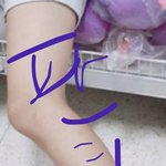 171 44키로 시절 다리 보여줌.. 나야나