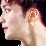 [NCT칠프] 이마크 <b>레이저</b> 찐이다