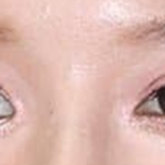 설윤 안면이 기괴한 이유가 있음. 짝눈이더라