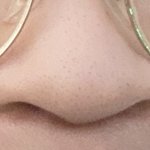 [꼭조언부탁] 아 코수술어케해야<b>할지</b> 조언좀...