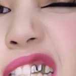 리사 <b>앞니</b> 썩었나봄