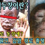 원숭이두창이란?  감염<b>경로</b> 동성애? 증상, 원인, 감염 <b>경로</b> 총정리