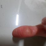[군대] ㅅㄷ) <b>굳은살</b> 때문에 손이 아프다...