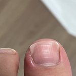 나제벌도와줘 내성<b>발톱</b>?잇는데