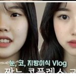 [댓글부탁해] 성형<b>전후</b>..이정도면 도전?ㅋㅋ