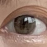 [댓글부탁해] 나보다 쌍수 망한<b>사림</b> 있냐