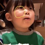 얼굴에 이런거 뭐야?