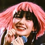 최근 치아교정 끝난 노제 교정 전후