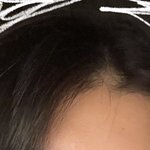 [댓글과조언] <b>정수리</b> 탈모 맞지..?