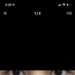 솔직히 이정도면 눈밑지방<b>재배치</b> 해도 ㄱㅊ?