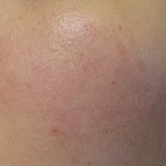 [댓글부탁해] 이<b>정도</b>면 <b>피부</b> 어떤거야...???
