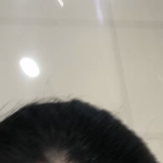 탈모 좀 봐줘