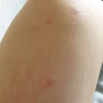 [댓글부탁해] 혐) 와 나 과다<b>출혈</b>로 병원 안간게 신기함