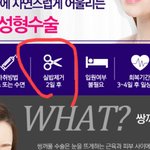 [댓글부탁해] 쌍수 해본 애들아 <b>실밥</b> 제거 하는거
