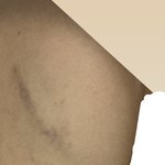 [댓글부탁해] 약혐) <b>어제</b> 아빠한테 쇠파이프로 맞아서