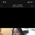 카리나 <b>성형</b>의혹