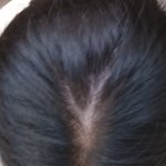 [댓글부탁해] 여자 정수리....<b>탈모</b>에요?