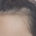 애들아 나 <b>탈모</b>야?ㅠㅠ