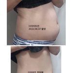 [다이어트] <b>복부</b>비만 다이어트 한달차