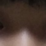 [댓글부탁해] 쌍수 성공햇다앙 ㅎㅎㅎㅎㅎ