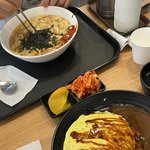 [드루와] 나 교정 중인데 고무줄은 언제 끼는 거야?