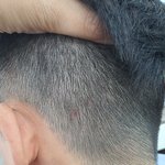 [댓글부탁해] 모@모@염색샴푸 <b>발진</b> 가려움 환불불가